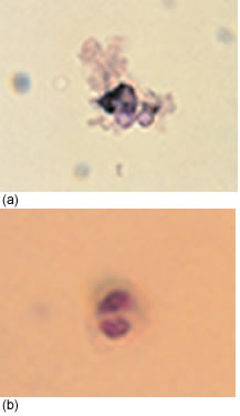 Nitroblue Tetrazolium Test